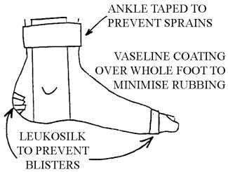 Example of ankle taping